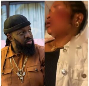 Hit & Run Accident: Timaya Breaks Silence, Visits The Injured Lady