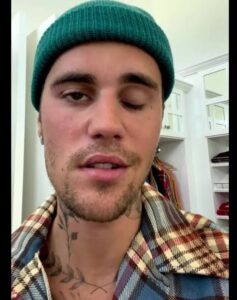 Justin Bieber Face Temporarily Paralyzed, Diagnosed With Ramsay Hunt Syndrome (VIDEO)