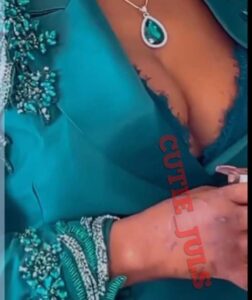 "Pray For Annie Idibia" Blogger Writes As She Shows Several Needle Marks On Annie's Hand, Suspects........