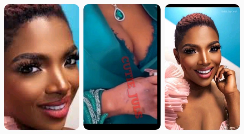 "Pray For Annie Idibia" Blogger Writes As She Shows Several Needle Marks On Annie's Hand, Suspects........