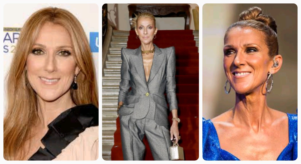 Celine Dion no longer has control of her muscles following her battl£ with Stiff-Person Syndrome — Sister