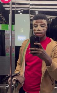 "Thanks for Giving Me My Dream Nose" – Skitmaker Zics Aloma Undergoes Facial Surgery in Turkey
